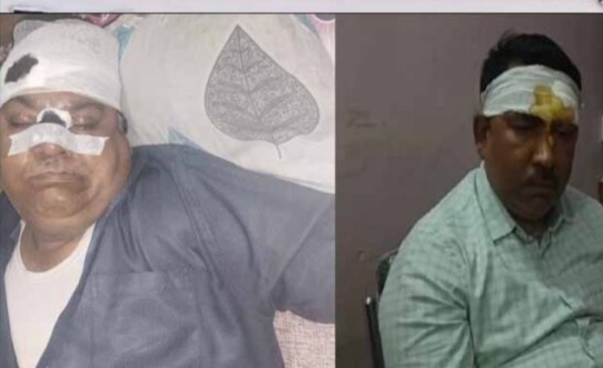 DEO का हेड मास्टर ने सर फोड़ा : स्कूल निरीक्षण में पहुंचे DEO व हेड मास्टर में हुआ जमकर मारपीट…,चले लात-घूंसे, दोनों के सर फूटे…,दोनों अस्पताल में भर्ती